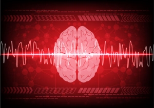 Exploring Stroke Types: Hemorrhagic Stroke